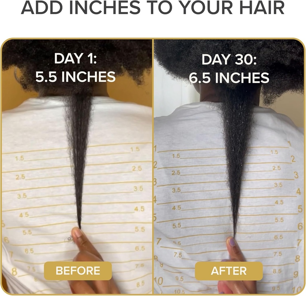 shedavi-iconic-natural-hair-vitamins-for-5.jpg