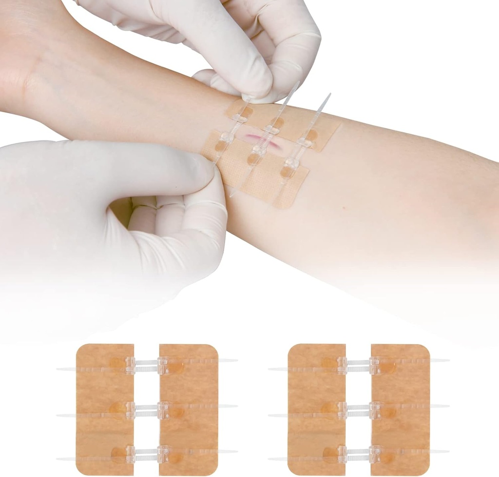 Zip Stitch Laceration Reparasjon Uten Stitches Butterfly Bandaids Quick Clot - Nødsår Lukking enhet 2 stykker (PU)