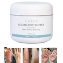 Cubed 4,5 oz Eczema Krem for voksne, Eczema Relief, Eczema behandling, moisturize tørr irridert hud, Smart lotion for emne steroid uttak symptomer, psoriasis & rosacea, Eczema, Dermatitis