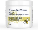Høy styrke Bee Venom Cream, Dyshidrotisk Eczema Ointment, Heat Rash, Kløe, Eczema, Psoriasis, Ben, Mage, Fot, Hånd, Irritert hud, Alle aldre omsorg