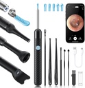 Loyker X6 ører Wax fjerningsverktøykamera, ørerenser med kamera, FSA - HSA Store kvalifisert, 1080P ørekamera med 6LED lys for øret / nese/Throat/Tonsil stein undersøkelse, svart