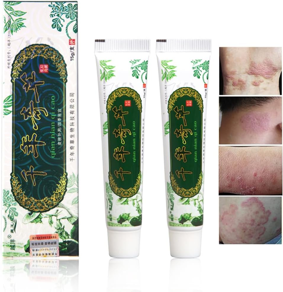 Oversjø tusen år Herbal Cream Kinesisk Herbal Eczema, Psoriasis Kremer Dermatitt og Eczema Pruritus Psoriasis JIULIN Ointment (2PCS)