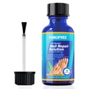 Toenail Fungus behandling Extra styrke - Nail Fungus behandling for tånail - Toe Nail Fungus behandling Ekstra styrke - Nail Fungus behandling (30ml)