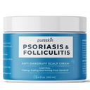 Scalp Soothing Cream for flammende hud, midlertidig relief av utseendet på tørr rød hud, 100ml