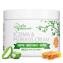 Wild Naturals Eczema & Psoriasis Krem for tørr, kløende hud – Eczema Relief for voksne og barn – Moisturizing Psoriasis Cream med Manuka Honning - Hydrating Honning Lotion for hender og ansikt