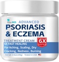 Bio-MD Psoriasis Eczema krem, Eczema krem for voksne, ekstra styrke kontroll reocecience, lindre symptom av motstandsdyktig, effektiv for seborrheic dermatitt, folliculitis behandling