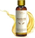Siya Ayurveda Psoriasis Behandlingsolje for naturlig relief | Olje for Scalp Psoriasis & hudpleie | Fjern Psoriasis fra røtter | laget med naturlige ingredienser - 100 ml