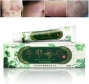 Oversea tusen år Herbal Cream Kinesisk Herbal Eczema, Psoriasis Kremer Dermatitt og Eczema Pruritus Psoriasis JIILIN Ointment