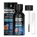 Toenail Fungus behandling, Nail Fungus behandling for tånegl, Nail Repair løsning, Fingerneils Renewal Liquid For Skaded & Discoloration Nail, Nail Fungus behandling, trygt og forsiktig - 30ML (1 FLOZ)