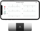 AliveCor KardiaMobile 6-Lead Personlig EKG Monitor - Seks visninger av hjertet - Deteksjoner AFib og uregelmessig Arrhythmias - Instant Results i 30 sekunder - Fungerer med de fleste smarttelefoner