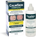 Xenna CalmSkin Komplett | Klinisk bevis til Soothe irritert hud og forbedre utseendet på huden med mild til moderat Psoriasis | Laget i USA 4 fl oz.